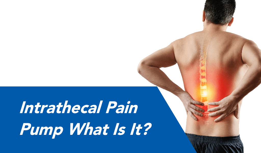 what is an intrathecal pain pump? image of man holding lower back