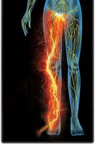 Complex Regional Pain Syndrome - one symptom is limbs on fire