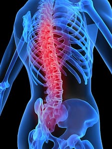 posture for improving back pain