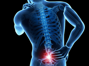 Chemotherapy Induced Peripheral Neuropathy