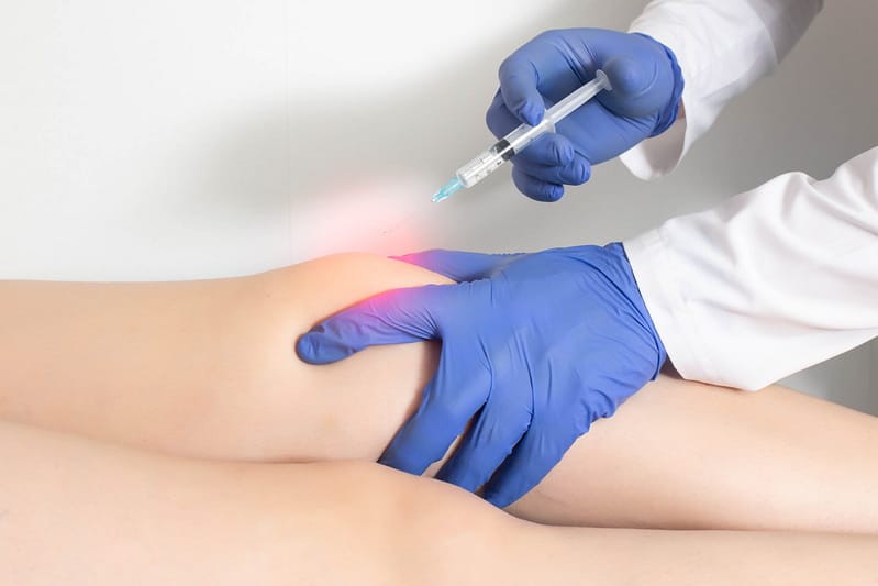 Doctor injects an ozone-oxygen mixture into the patient's knee joint to relieve muscle spasm and inflammation. Ozone therapy.